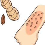 「うんこ移植」でピーナツアレルギー改善、15人中6人が数粒食べられるように　ヒトの実証は初　Science系列誌掲載