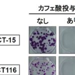 コーヒー「カフェ酸」、大腸がん増殖抑制 京都府立医大など解明 | 日刊工業新聞 電子版